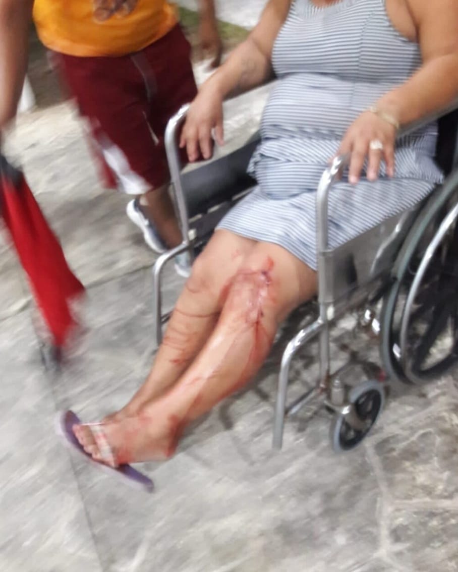 Una mujer herida de bala en Cancún Fracc. Villas del Mar.