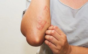 La "crema maravillosa" Barcicil puede ser dañina para la salud.