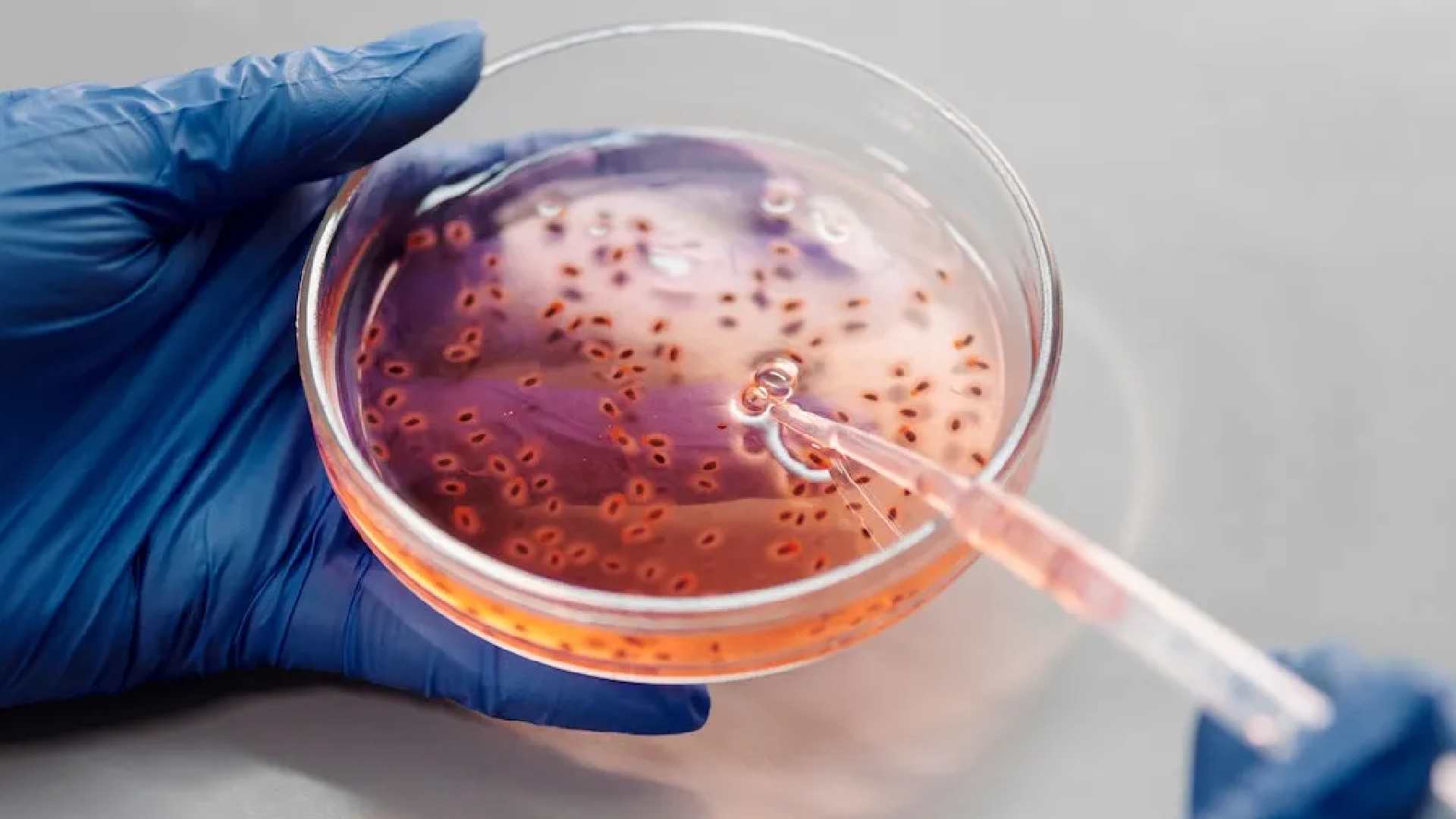 Bacteria carnívora provoca alarma en el mundo: te diremos de qué se trata.