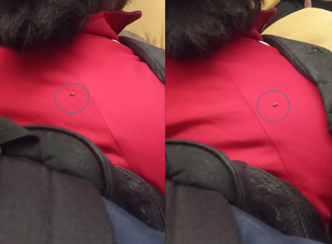 Captan un insecto en espalda de un hombre en el Metro de la CDMX ¿Es chinche o cucaracha? (Video)