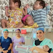 Trillizos prematuros sobreviven 2 niñas y un varón nacieron a las 32 semanas de gestación