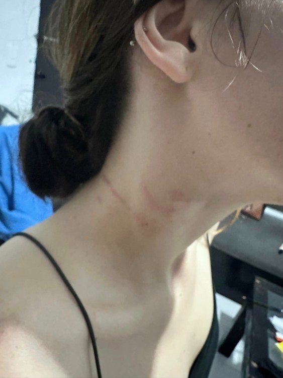 Recibe una menor de edad golpiza de policías en Cancún