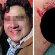 Una mujer, en medio de un aparente ataque de celos, le habría cortado el pene a su pareja mientras este se encontraba durmiendo