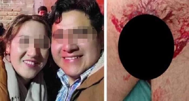 Una mujer, en medio de un aparente ataque de celos, le habría cortado el pene a su pareja mientras este se encontraba durmiendo