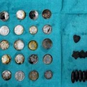 Cirujanos retiran 39 monedas