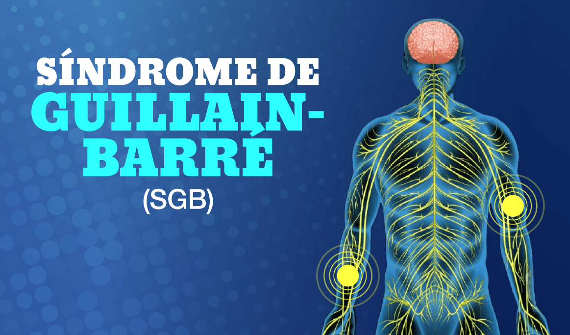 Epidemia del síndrome Guillain-Barré