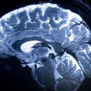 La imagen más detallada de un cerebro