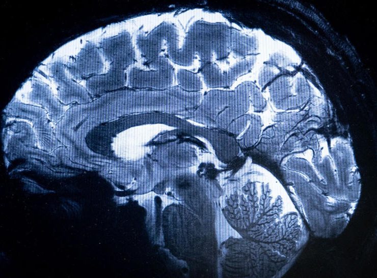 La imagen más detallada de un cerebro