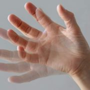 El Parkinson enfermedad neurodegenerativa ¿Qué sabemos de esta enfermedad?