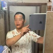 Joven asegura que fue golpeado y drogado en un bar de Mérida