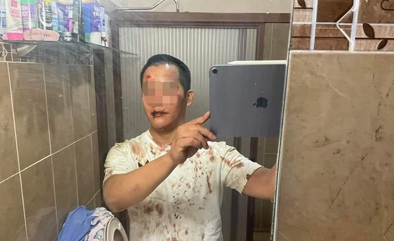 Joven asegura que fue golpeado y drogado en un bar de Mérida