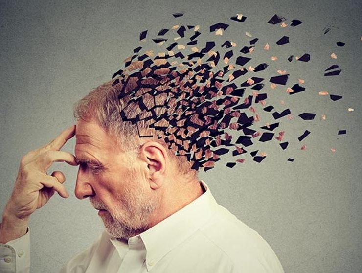 Descubren 5 tipos de Alzheimer