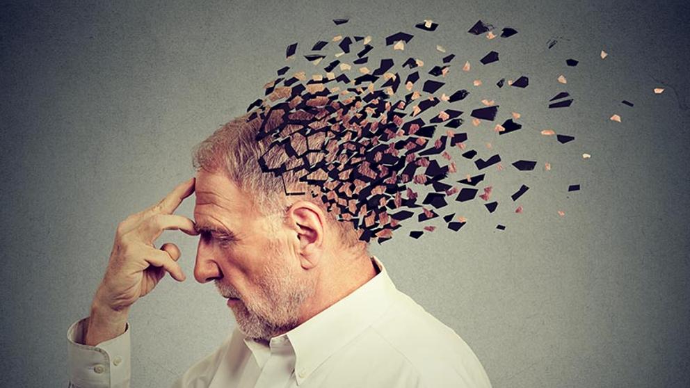 Descubren 5 tipos de Alzheimer