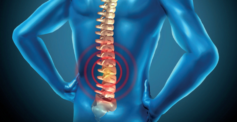 Crean medicamento para la espondilitis anquilosante