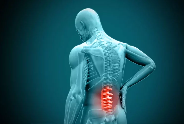 Crean medicamento para la espondilitis anquilosante