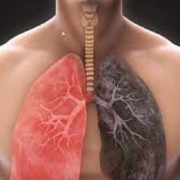 Crean un fármaco para los pulmones dañados