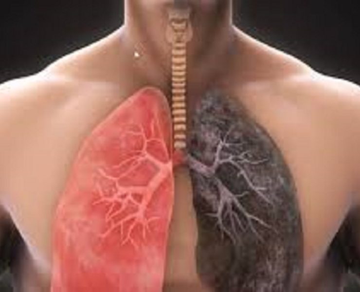 Crean un fármaco para los pulmones dañados