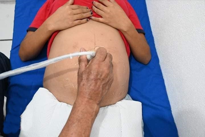 El IMSS de Ciudad del Carmen requiere de una UCIN