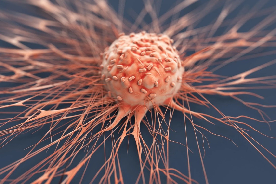 Un nuevo estudio para detectar cáncer de próstata