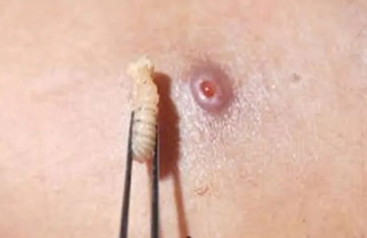 El primer fallecido por un gusano barrenador