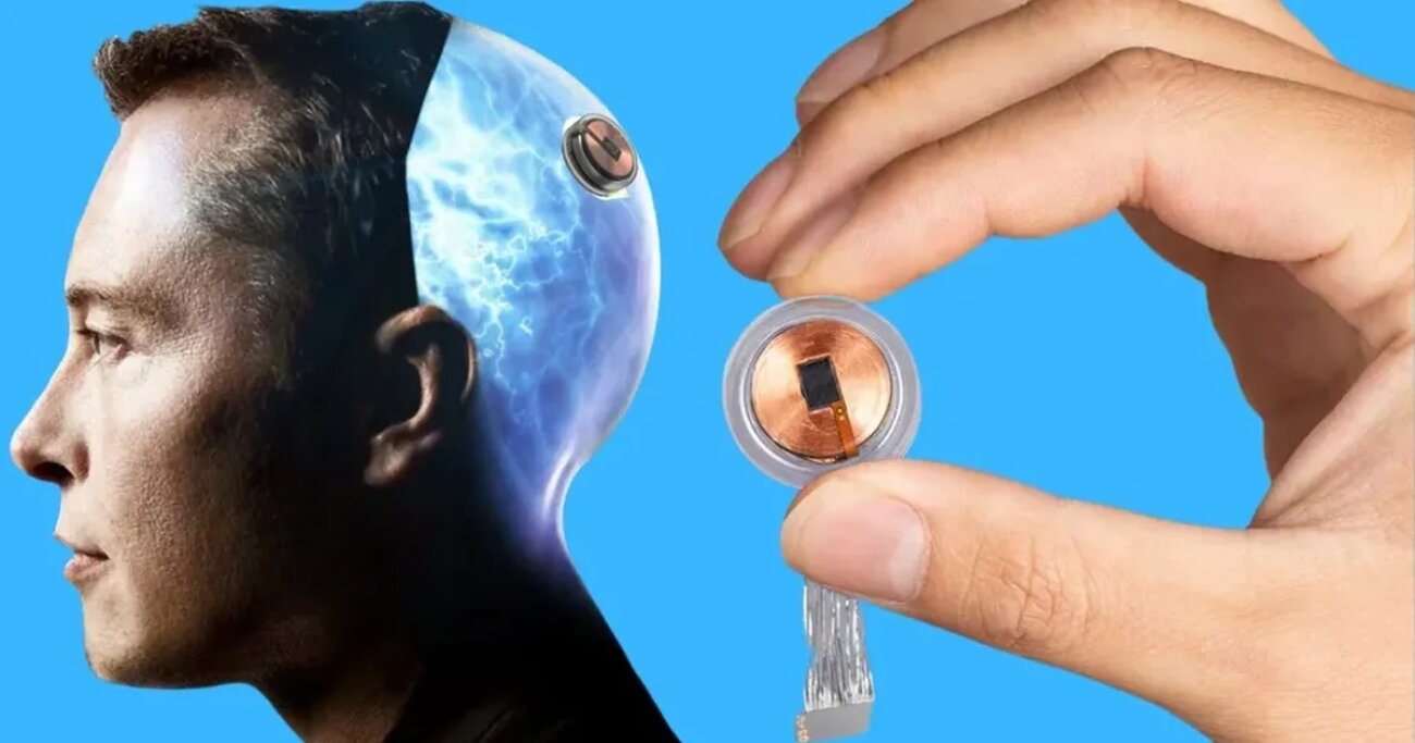La segunda prueba de Neuralink es un éxito