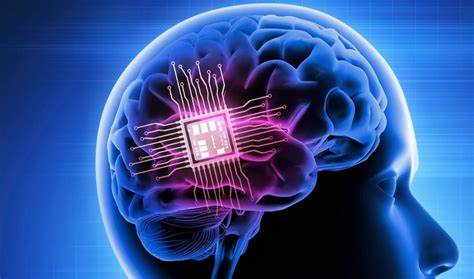 Un chip cerebral combate la epilepsia