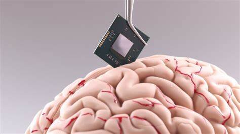La segunda prueba de Neuralink es un éxito