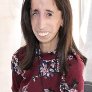 Fea por Fuera y con Enorme Belleza por Dentro