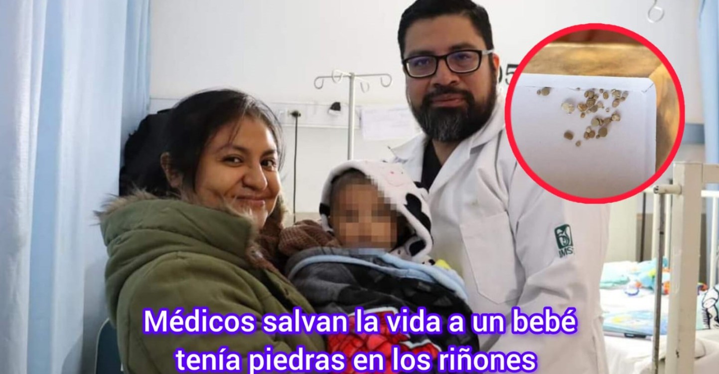 Médicos salvan la vida a un bebé con Piedras en los Riñones en el IMSS de Mérida