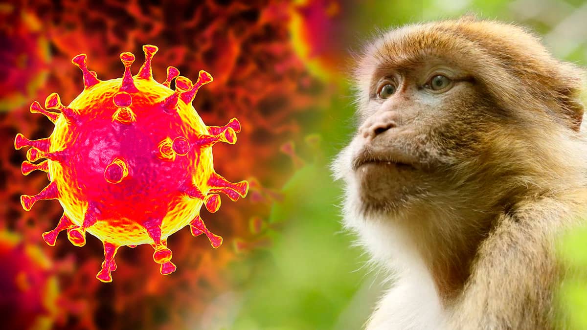 ¿Qué es la Viruela del Mono?