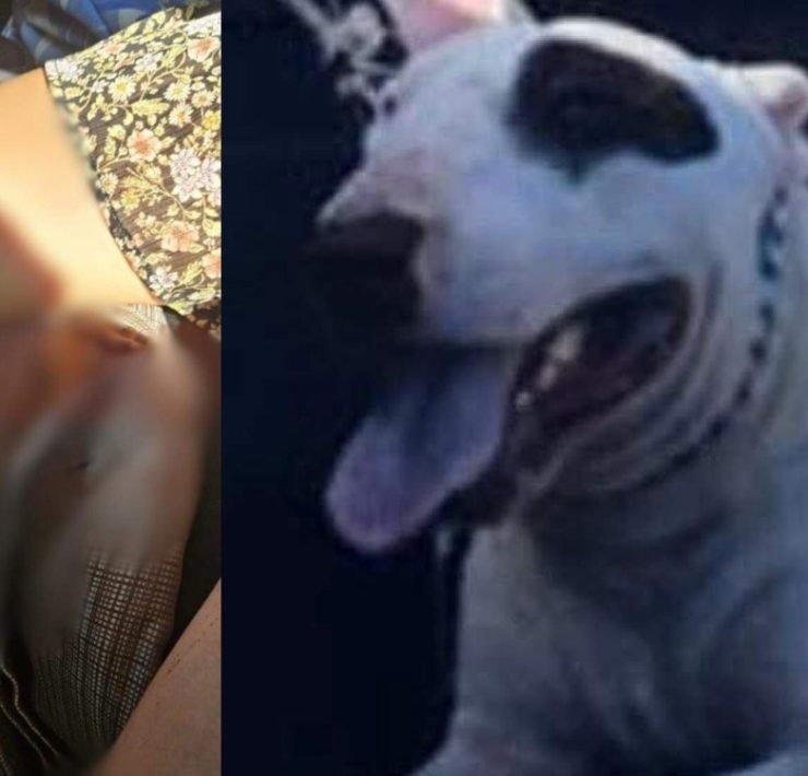 Joven gravemente herida tras brutal ataque de Bull terrier en Mérida