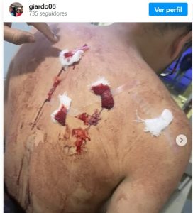 Hinchas de Atlas y Chivas protagonizan un enfrentamiento que terminó con un aficionado de los rojinegros acuchillado dentro del Estadio Akron.