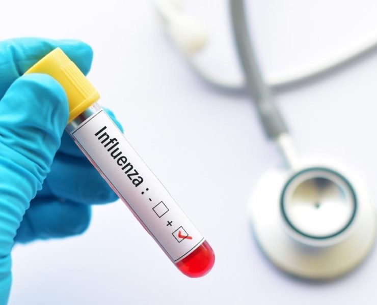 Casos de influenza en Yucatán