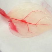 Usan hojas de espinacas para construir músculos cardiacos