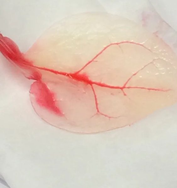 Usan hojas de espinacas para construir músculos cardiacos