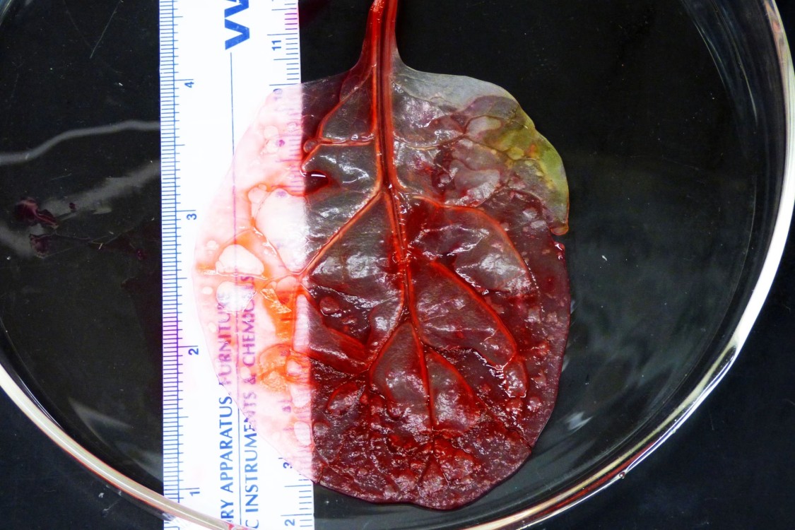 El uso de hojas de espinacas en la medicina regenerativa