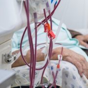 Aumento de casos de insuficiencia renal saturan hospitales de Tabasco