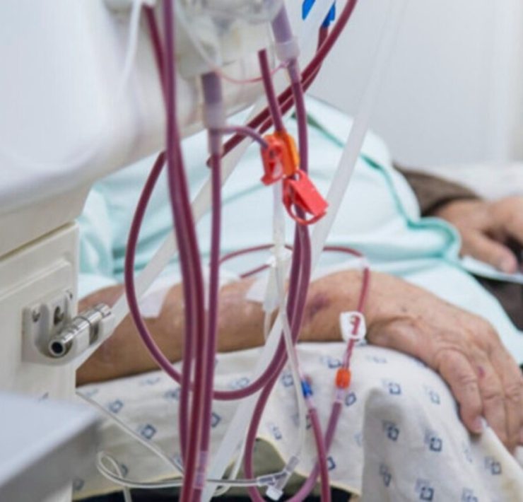 Aumento de casos de insuficiencia renal saturan hospitales de Tabasco