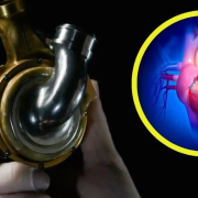 Paciente vivió 100 días con corazón de titanio: Revolución médica