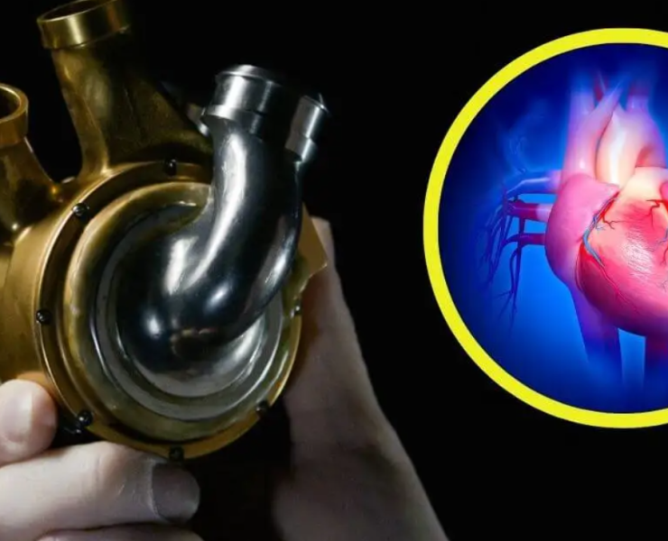 Paciente vivió 100 días con corazón de titanio: Revolución médica
