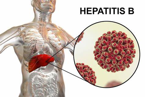Un avance significativo en la lucha contra la hepatitis B