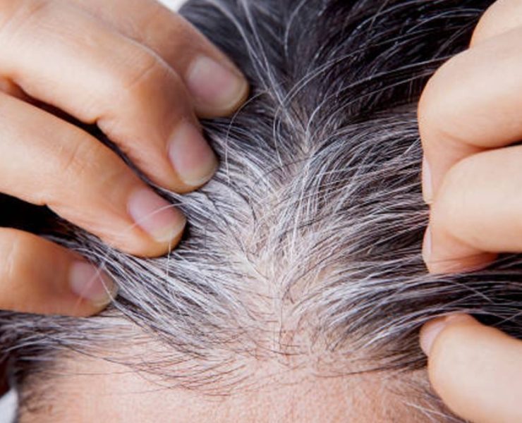 ¿Cómo eliminar las canas? Investigadores de Japón hablan