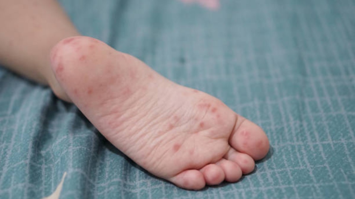 Recomendaciones para evitar el contagio