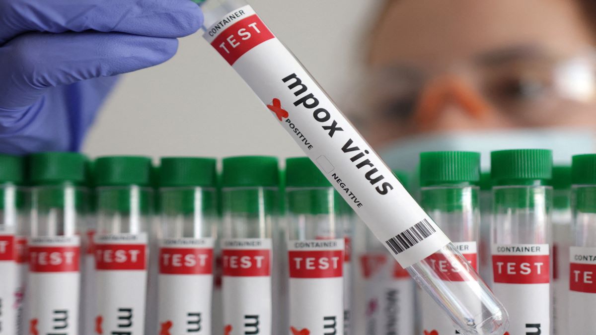 Reino Unido identifica 4 casos de mpox y el mundo reacciona