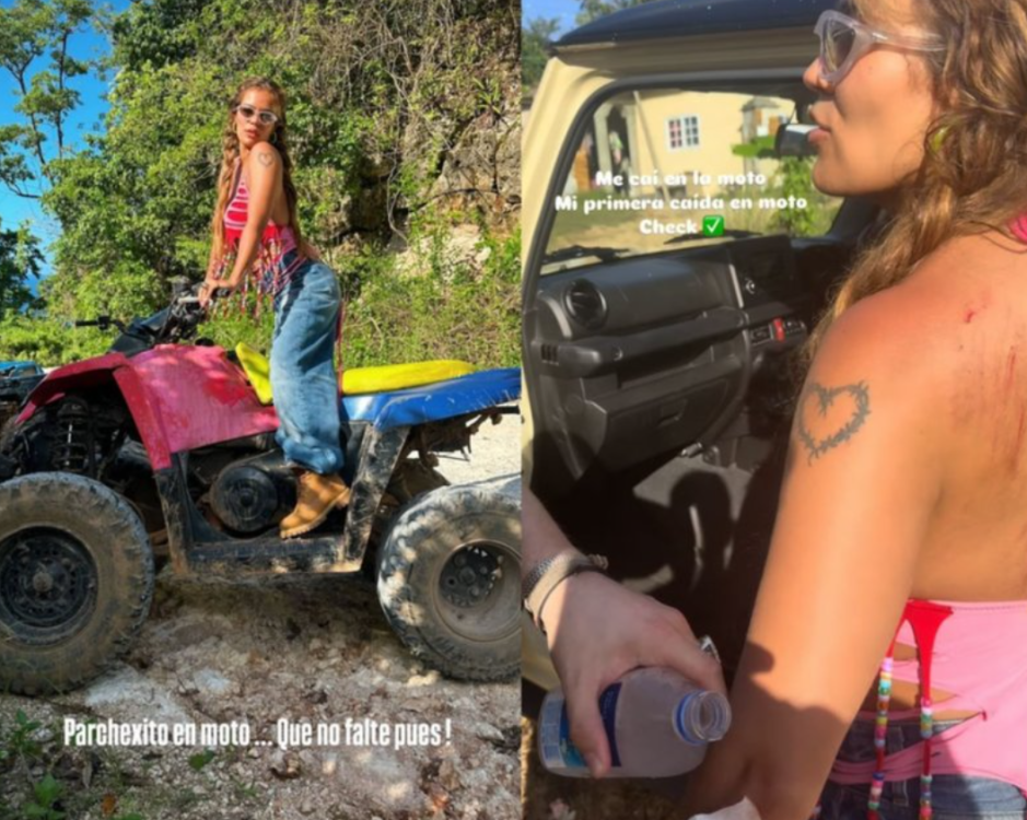 Detalles del accidente de Karol G en moto