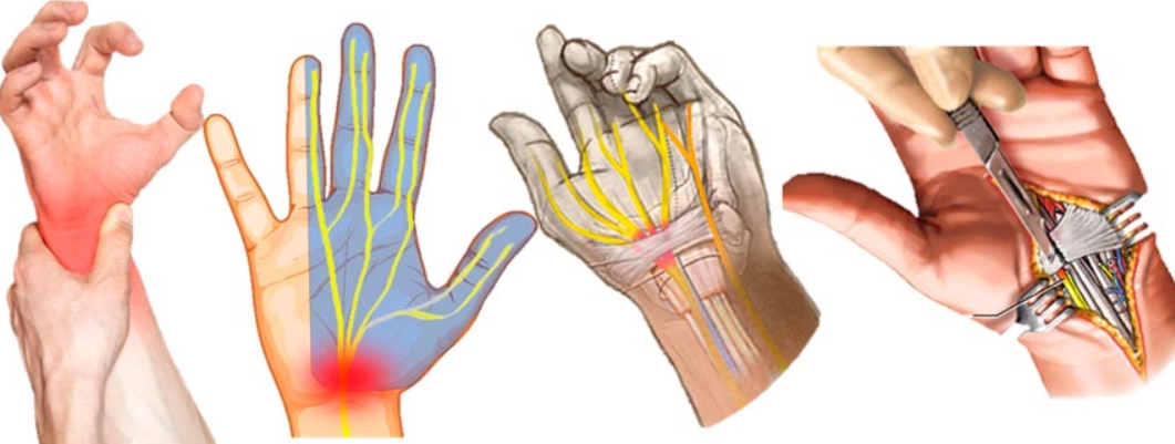 Ventajas del guante inteligente frente a otros dispositivos