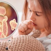 Confirman cuatro casos de tos ferina en Tabasco