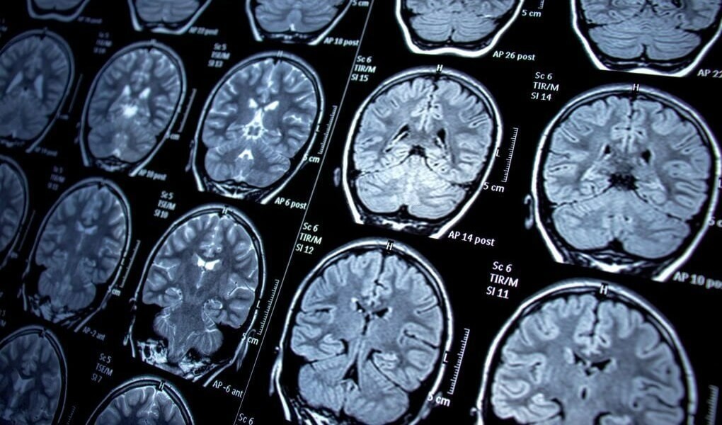 Hábitos que marcan la diferencia