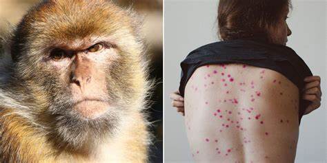 Mpox sigue siendo amenaza: un riesgo que no desaparece