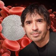 Síntomas del linfoma de Hodgkin